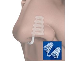 Anti snurk neus spreider -  4 stuks met opbergdoosje