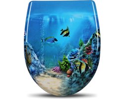 Antibacteriële Toiletbril Visjes - WC Bril - Met Softclose - Universeel - Toiletbrillen – Toiletzitting