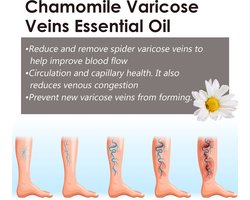 Essentiële olie van kamille beschermt de huid van de benen en verlicht ongemakken met dagelijkse massage-etherische olie.