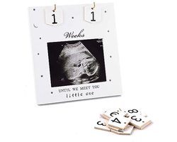 Fotolijst voor echografie, fotolijst voor baby-echo, aftelweken, zwangerschapsaankondiging, fotolijsten, maak kennis met je baby, decoratie