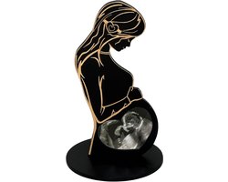 Fotolijstje voor echografie, displaybord voor echografiefoto's, moderne herinnering en decoratie voor het onthullen van het geslacht van de baby voor zwangerschapsaankondigingen, babymoeders, ouders en grootouders