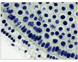 Poster 160x120 cm - Blauwe cellen onder de microscoop - Posters - Kamer decoratie - Wanddecoratie woonkamer - Muurdecoratie slaapkamer XXL
