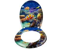 Toiletbril toilet deksel verlagen automatische reductie met een verlaging en softclose, universele maat toiletzitje gemaakt van harde plastic cloters gemaakt van thuroplast (zoetwater decoratieve vis)