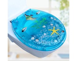 Universele Softclose Toiletbril – Langzaam Sluitende WC Bril met RVS Scharnieren – Comfortabele Dikke Toiletzitting – U/V/O Vorm Geschikt