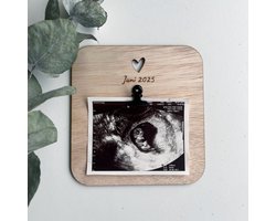 Zwangerschapsaankondiging - Echo - Baby echo - Zwangerschap bekendmaken
