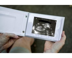 Zwangerschapsalbum en Plakboek voor Echobeelden en Foto's